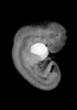 day 32 human embryo MRI animation