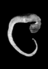 day 32 human embryo MRI animation