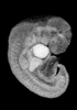 day 32 human embryo MRI animation