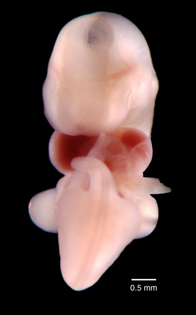 human embryo photograph