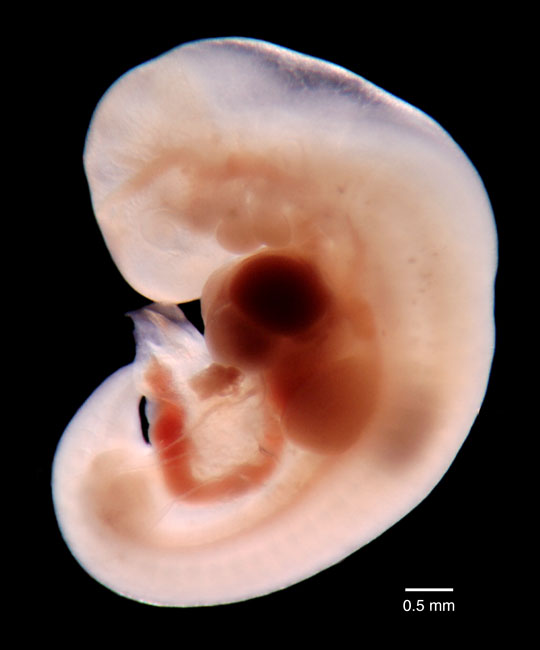 human embryo photograph