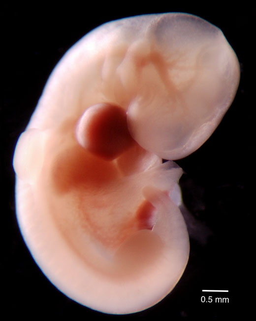 human embryo photograph