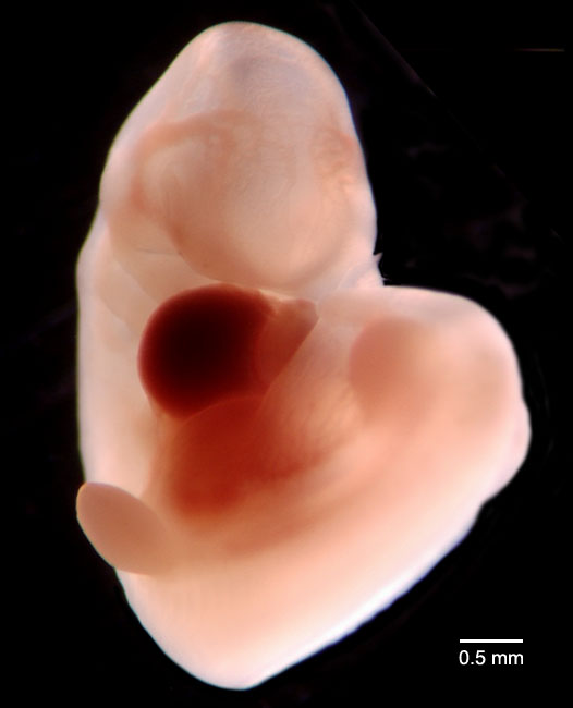 human embryo photograph