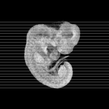 axial slice image map