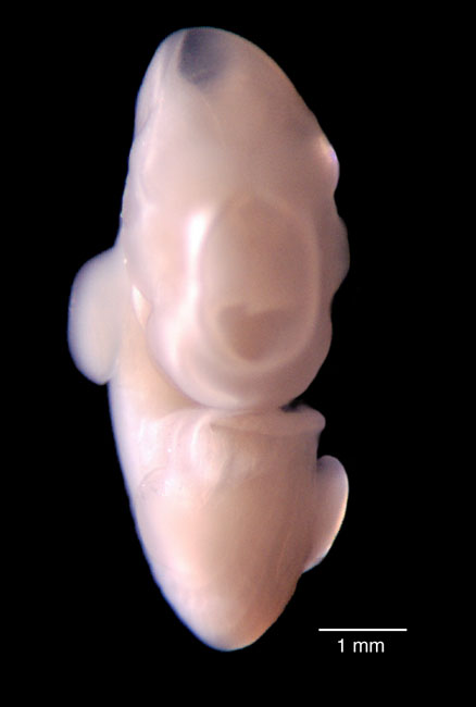 human embryo photograph