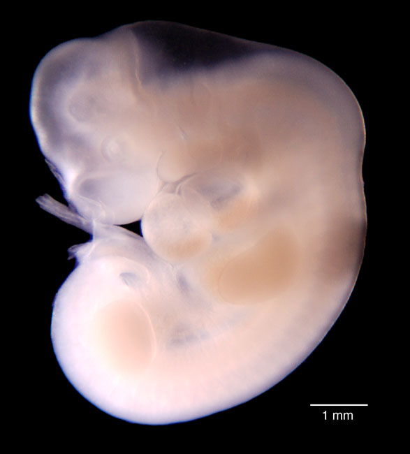human embryo photograph