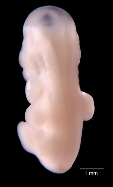 human embryo photograph