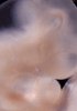 day 33 human embryo photograph
