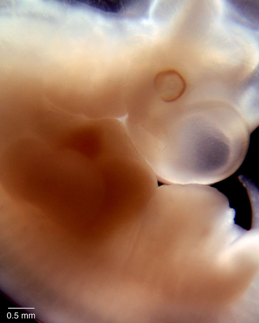 human embryo photograph