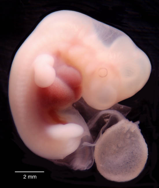 human embryo photograph