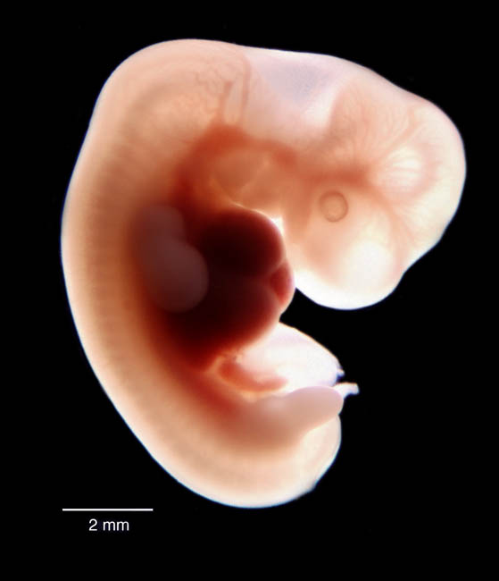 human embryo photograph