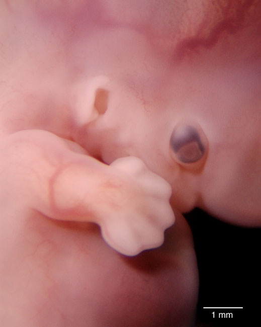 human embryo photograph