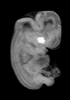 day 47 human embryo MRI animtaion