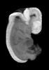 day 47 human embryo MRI animtaion