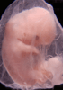 day 47 human embryo photograph