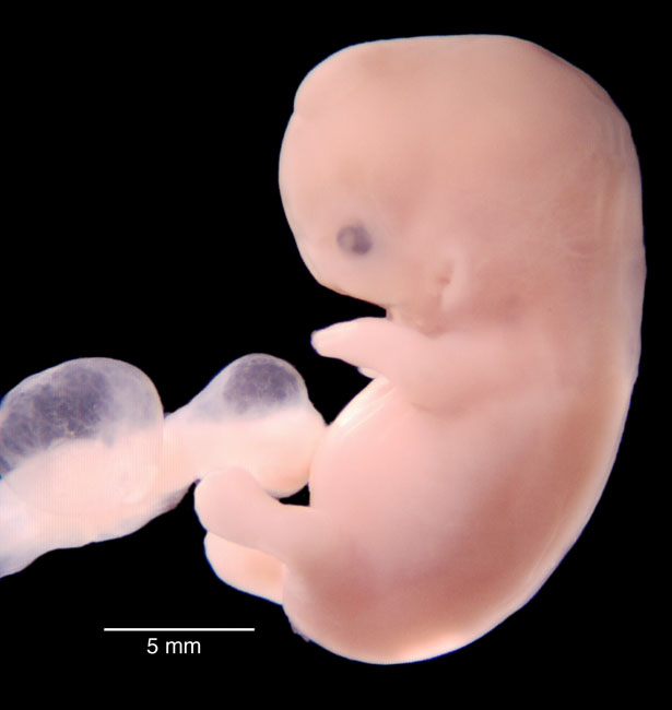 human embryo photograph