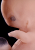 day 47 human embryo photograph
