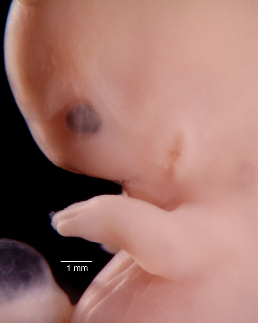 human embryo photograph