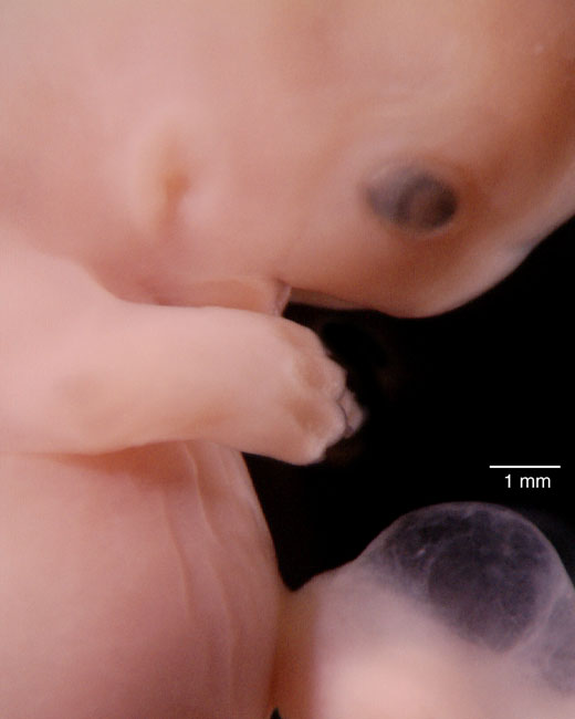 human embryo photograph