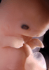 day 47 human embryo photograph