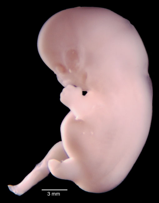 human embryo photograph