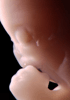 day 47 human embryo photograph