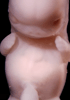 day 47 human embryo photograph
