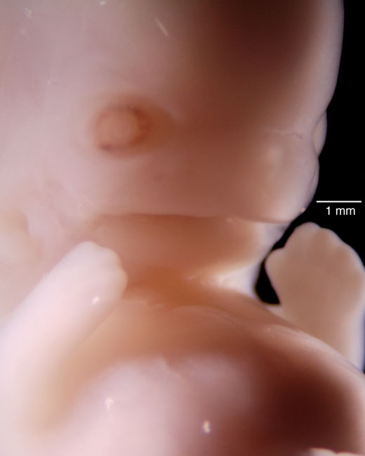 human embryo photograph