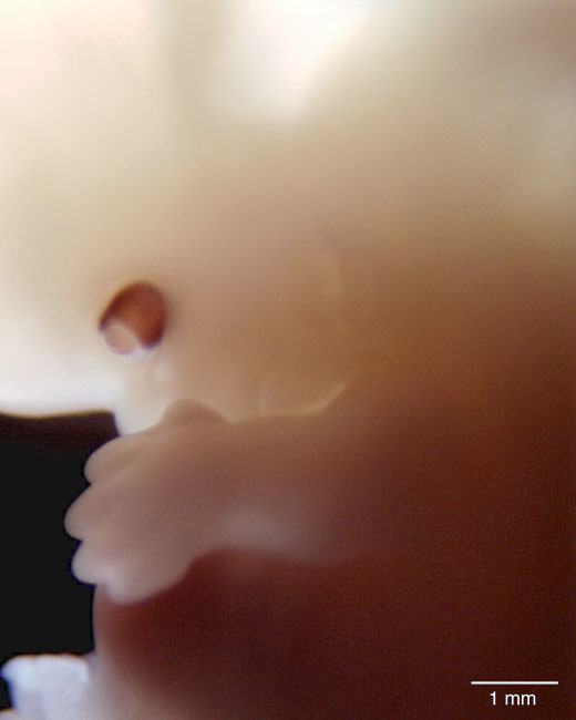 human embryo photograph