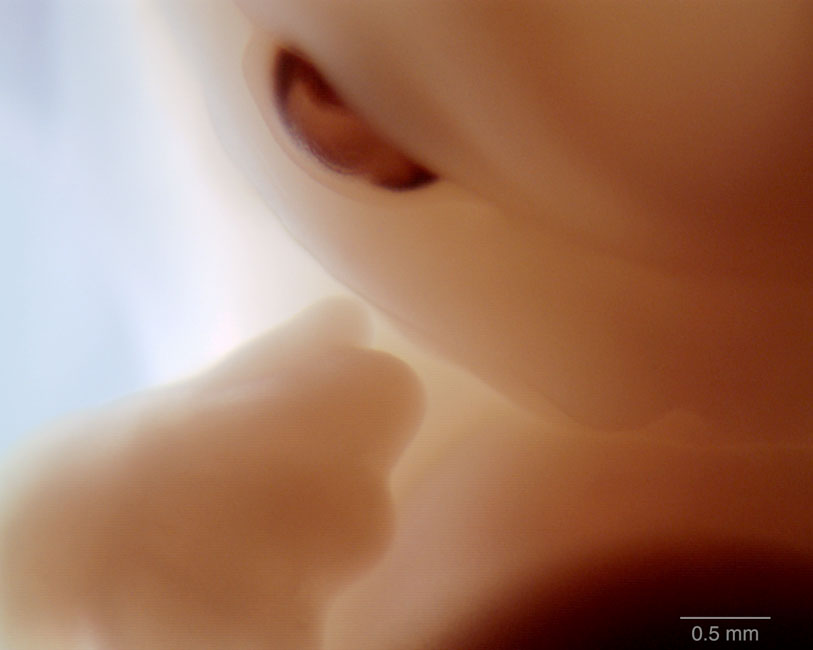 human embryo photograph