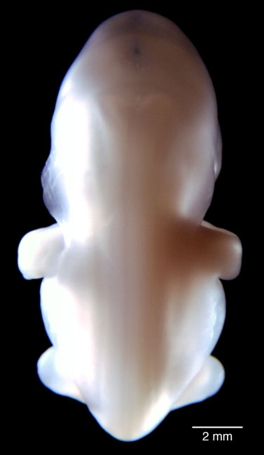 human embryo photograph