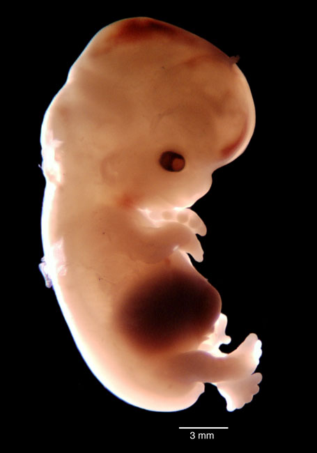 human embryo photograph