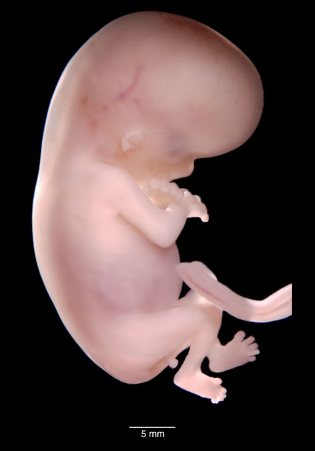 human embryo photograph
